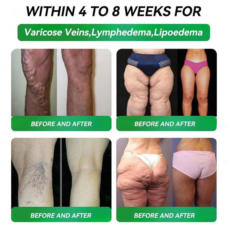 Official Store🍀NATRAVOR®NAD+  GLP-1 Fit & Vital Oral Liquid👩‍❤️‍👨(Just once a day,visible changes in 7 days)✅For obesity,cardiovascular health,diabetes,sleep apnea,Gut Health,joint issues,and more