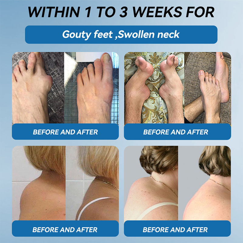 Official store 👩‍⚕️🥇| NATRAVOR® BPC-157 Joint Healing Cream🏃‍Treats Arthritis,Neuropathy,Rheumatism,Sports Injuries&More👍